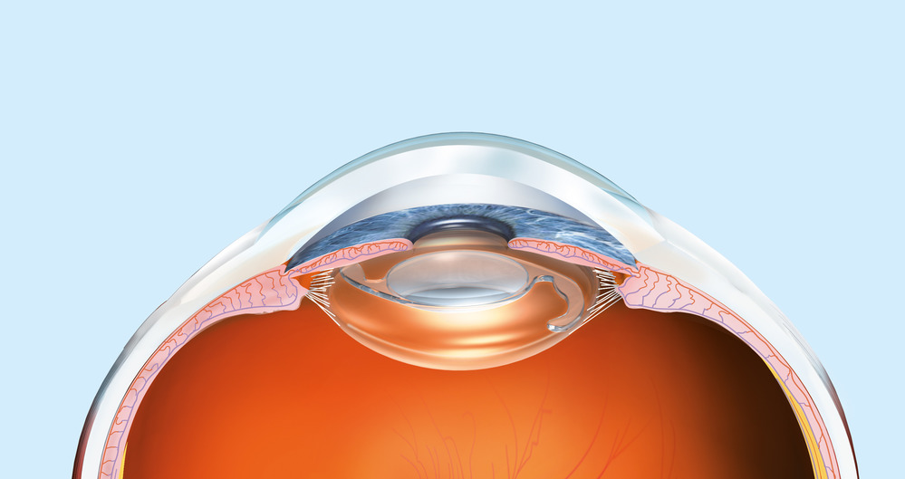 Operation des Grauen Stars mit Laser